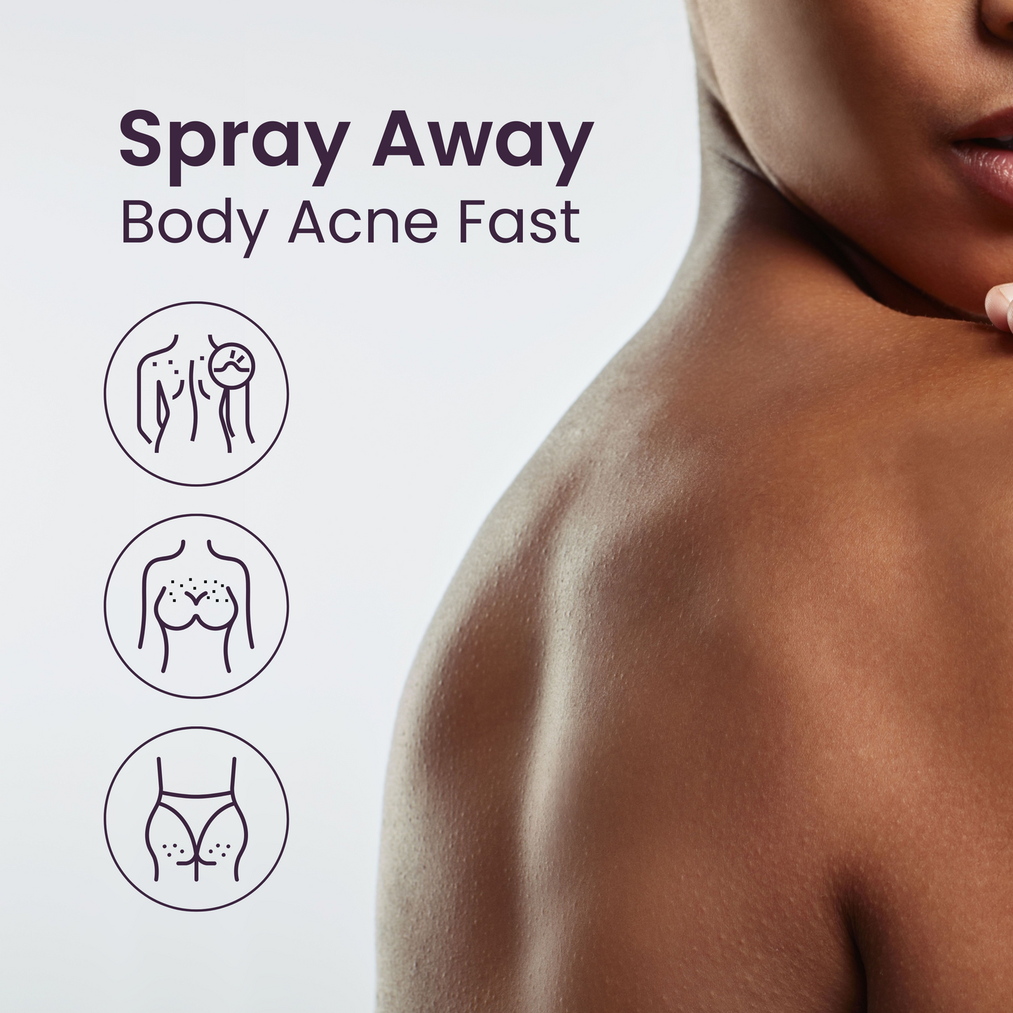 Acne Fighting Body Spray