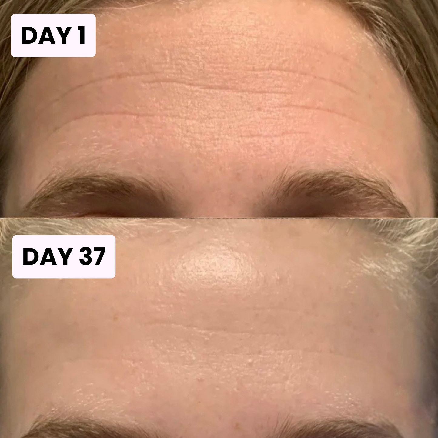 PDRN Glow & Elasticity Balm