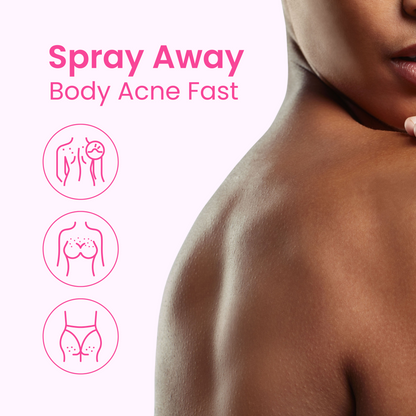 Acne Fighting Body Spray