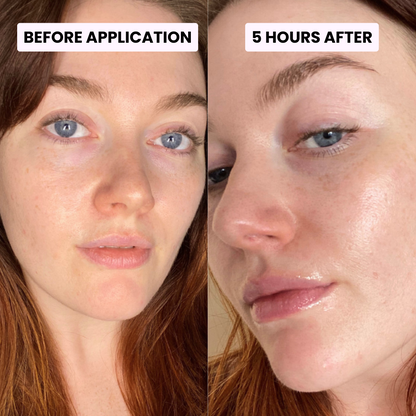 PDRN Glow & Elasticity Balm