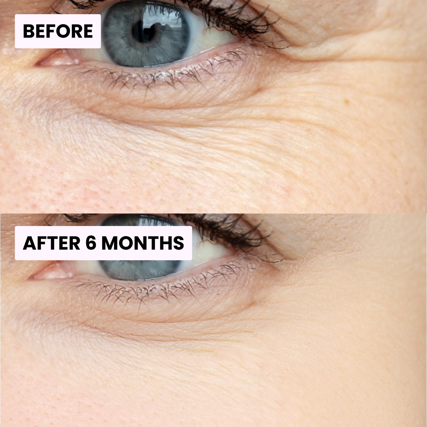 PDRN Glow & Elasticity Balm